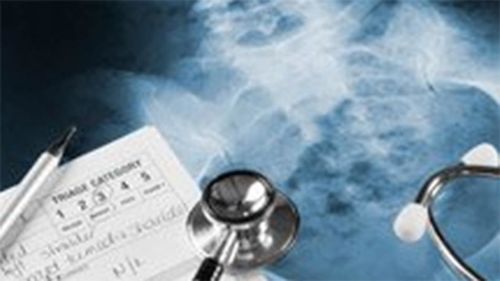 indianapolis car accident lawyer